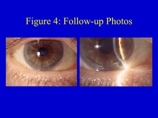 Figure 4: Follow-up Photos 