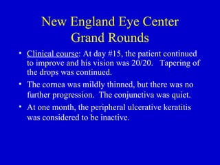 New England Eye Center Grand Rounds Clinical course : At day #15, the patient continued to improve and his vision was 20/20.  Tapering of the drops was continued. The cornea was mildly thinned, but there was no further progression.  The conjunctiva was quiet. At one month, the peripheral ulcerative keratitis was considered to be inactive. 