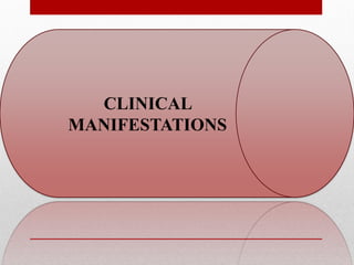 CLINICAL
MANIFESTATIONS
 