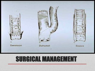 SURGICAL MANAGEMENT
 