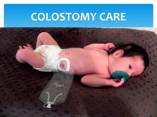 COLOSTOMY CARE
 