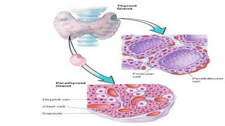 Parathyroid Eye HYPERPARATHYROIDISM : ETIOLOGY, PATHOGENESIS & DIAGNOSIS. | PPTX