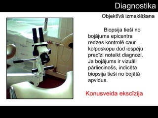 Diagnostika
Biopsija tieši no
bojājuma epicentra
redzes kontrolē caur
kolposkopu dod iespēju
precīzi noteikt diagnozi.
Ja bojājums ir vizuāli
pārliecinošs, indicēta
biopsija tieši no bojātā
apvidus.
Objektīvā izmeklēšana
Konusveida ekscīzija
 