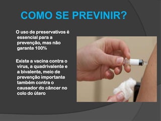 COMO SE PREVINIR?
O uso de preservativos é
essencial para a
prevenção, mas não
garante 100%
Existe a vacina contra o
vírus, a quadrivalente e
a bivalente, meio de
prevenção importante
também contra o
causador do câncer no
colo do útero

 