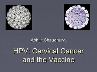 HPV: Cervical CancerHPV: Cervical Cancer
and the Vaccineand the Vaccine
Abhijit Chaudhury.Abhijit Chaudhury.
 