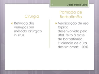 Cirurgia
 Retirada das
verrugas por
método cirúrgico
in situs.
Pomada de
Barbatimão
 Medicação de uso
tópico
desenvolvido pela
Ufal, feito à base
de barbatimão.
Eficiência de cura
dos sintomas: 100%
João Paulo Leite16
 