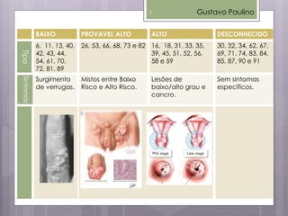 Gustavo Paulino
BAIXO PROVAVEL ALTO ALTO DESCONHECIDO
Tipo
6, 11, 13, 40,
42, 43, 44,
54, 61, 70,
72, 81, 89
26, 53, 66, 68, 73 e 82 16, 18, 31, 33, 35,
39, 45, 51, 52, 56,
58 e 59
30, 32, 34, 62, 67,
69, 71, 74, 83, 84,
85, 87, 90 e 91
Sintomas
Surgimento
de verrugas.
Mistos entre Baixo
Risco e Alto Risco.
Lesões de
baixo/alto grau e
cancro.
Sem sintomas
específicos.
7
 