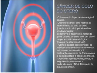-O tratamento depende do estágio do
câncer.
Quando o câncer está restrito ao
revestimento do colo do útero
(carcinoma in situ), geralmente o
médico é capaz
de removê-lo totalmente, retirando
parte do colo do útero com um bisturi
ou por excisão eletrocirúrgica
(cirurgia de alta frequência).
- Como o câncer pode reincidir, os
médicos aconselham as mulheres a
retornarem ao controle e à
realização do exame de Papanicolau
e da colposcopia a cada seis meses.
- Após dois resultados negativos, o
seguimento passa a ser a
cada três anos (INCA, Ministério da
Saúde do Brasil).
 