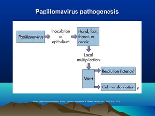 From Medical Microbiology, 5th
ed., Murray, Rosenthal & Pfaller, Mosby Inc., 2005, Fig. 52-3.
Papillomavirus pathogenesis
 