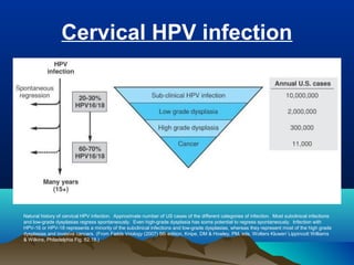 Cervical HPV infection
Natural history of cervical HPV infection. Approximate number of US cases of the different categories of infeciton. Most subclinical infections
and low-grade dysplasias regress spontaneously. Even high-grade dysplasia has some potential to regress spontaneously. Infection with
HPV-16 or HPV-18 represents a minority of the subclinical infections and low-grade dysplasias, whereas they represent most of the high grade
dysplasias and invasive cancers. (From Fields Vriology (2007) 5th edition, Knipe, DM & Howley, PM, eds, Wolters Kluwer/ Lippincott Williams
& Wilkins, Philadelphia Fig. 62.18.)
 
