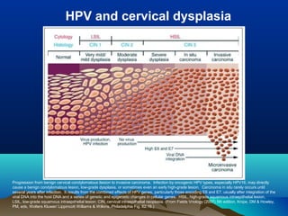 Progression from benign cervical condylomatous liesion to invasive carcinoma. Infection by oncogenic HPV types, especially HPV16, may directly
cause a benign condylomatous lesion, low-grade dysplasia, or sometimes even an early high-grade lesion. Carcinoma in situ rarely occurs until
several years after infection. It results from the combined effects of HPV genes, particularly those encoding E6 and E7, usually after integration of the
viral DNA into the host DNA and a series of genetic and epigenetic changes in cellular genes. HSIL, high-grade squamous intraepithelial lesion,
LSIL, low-grade squamous intraepithelial lesion; CIN, cervical intraepithelial neoplasia. (From Fields Vriology (2007) 5th edition, Knipe, DM & Howley,
PM, eds, Wolters Kluwer/ Lippincott Williams & Wilkins, Philadelphia Fig. 62.16.)
HPV and cervical dysplasia
 