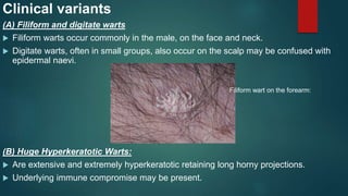 Human Papilloma Virus Made Very Easy! | PPTX