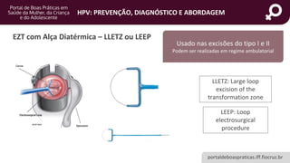 portaldeboaspraticas.iff.fiocruz.br
HPV: PREVENÇÃO, DIAGNÓSTICO E ABORDAGEM
EZT com Alça Diatérmica – LLETZ ou LEEP
LLETZ: Large loop
excision of the
transformation zone
LEEP: Loop
electrosurgical
procedure
Usado nas excisões do tipo I e II
Podem ser realizadas em regime ambulatorial
 