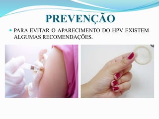 PREVENÇÃO
 PARA EVITAR O APARECIMENTO DO HPV EXISTEM
ALGUMAS RECOMENDAÇÕES.
 