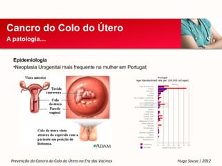 Cancro do Colo do Útero
A patologia…


  Epidemiologia
  •Neoplasia Urogenital mais frequente na mulher em Portugal;




 Prevenção do Cancro do Colo do Útero na Era das Vacinas        Hugo Sousa | 2012
 