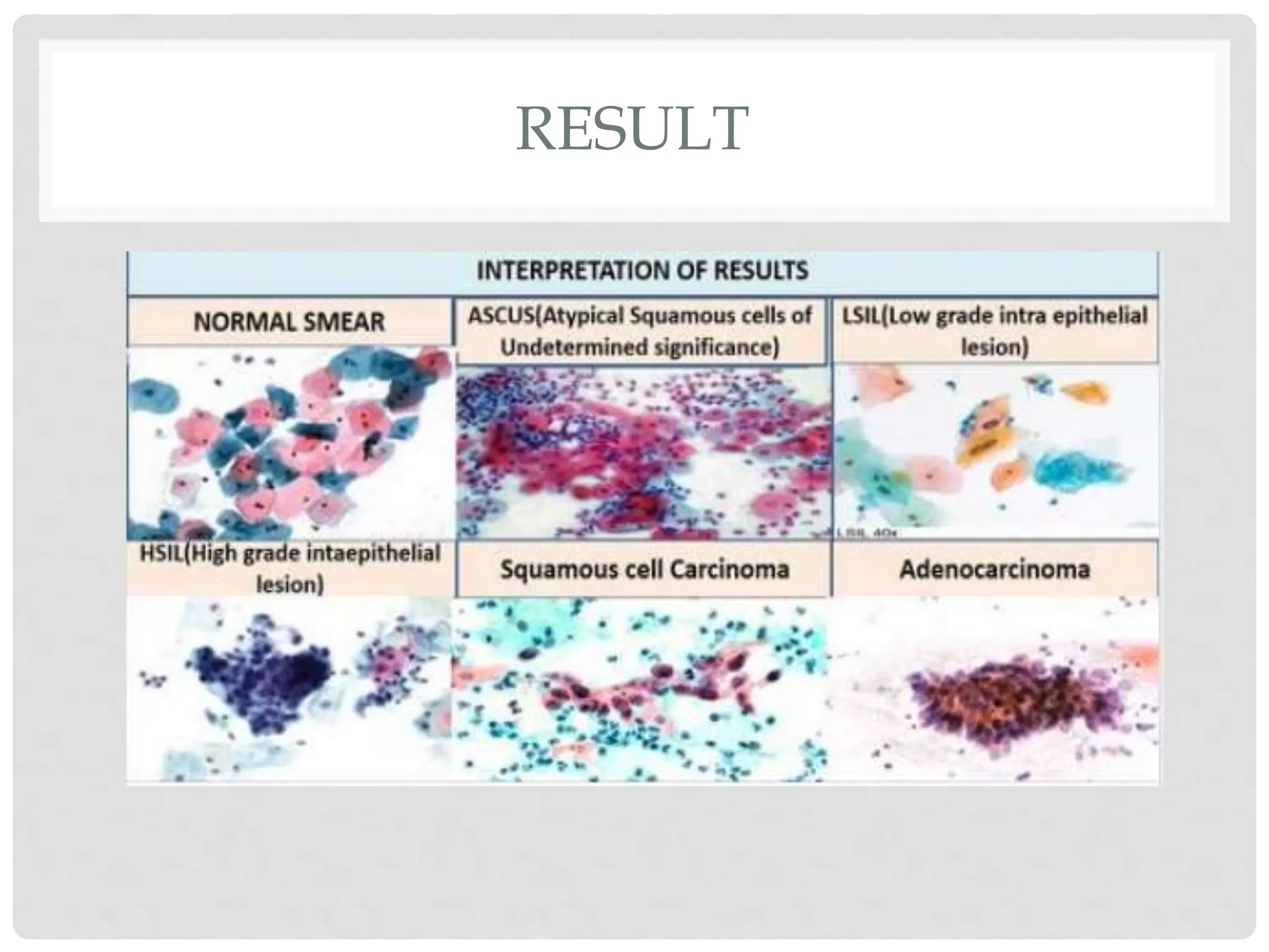 Human Papilloma Virus AND CERVICAL CANCER.pptx