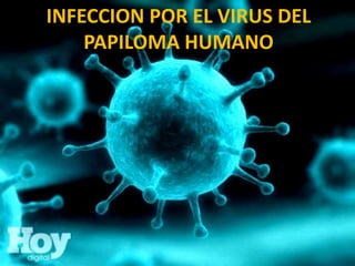 INFECCION POR EL VIRUS DEL
PAPILOMA HUMANO
 