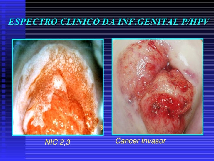 Hpv disciplina 2010 2.sem