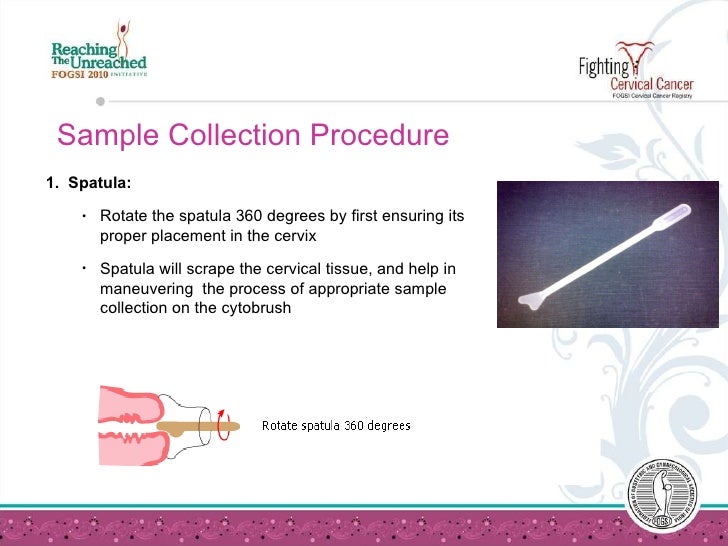 pap smear test