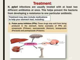 H pylori 3.pptx
