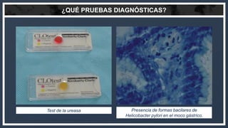 ¿QUÉ PRUEBAS DIAGNÓSTICAS?
Test de la ureasa Presencia de formas bacilares de
Helicobacter pylori en el moco gástrico.
 