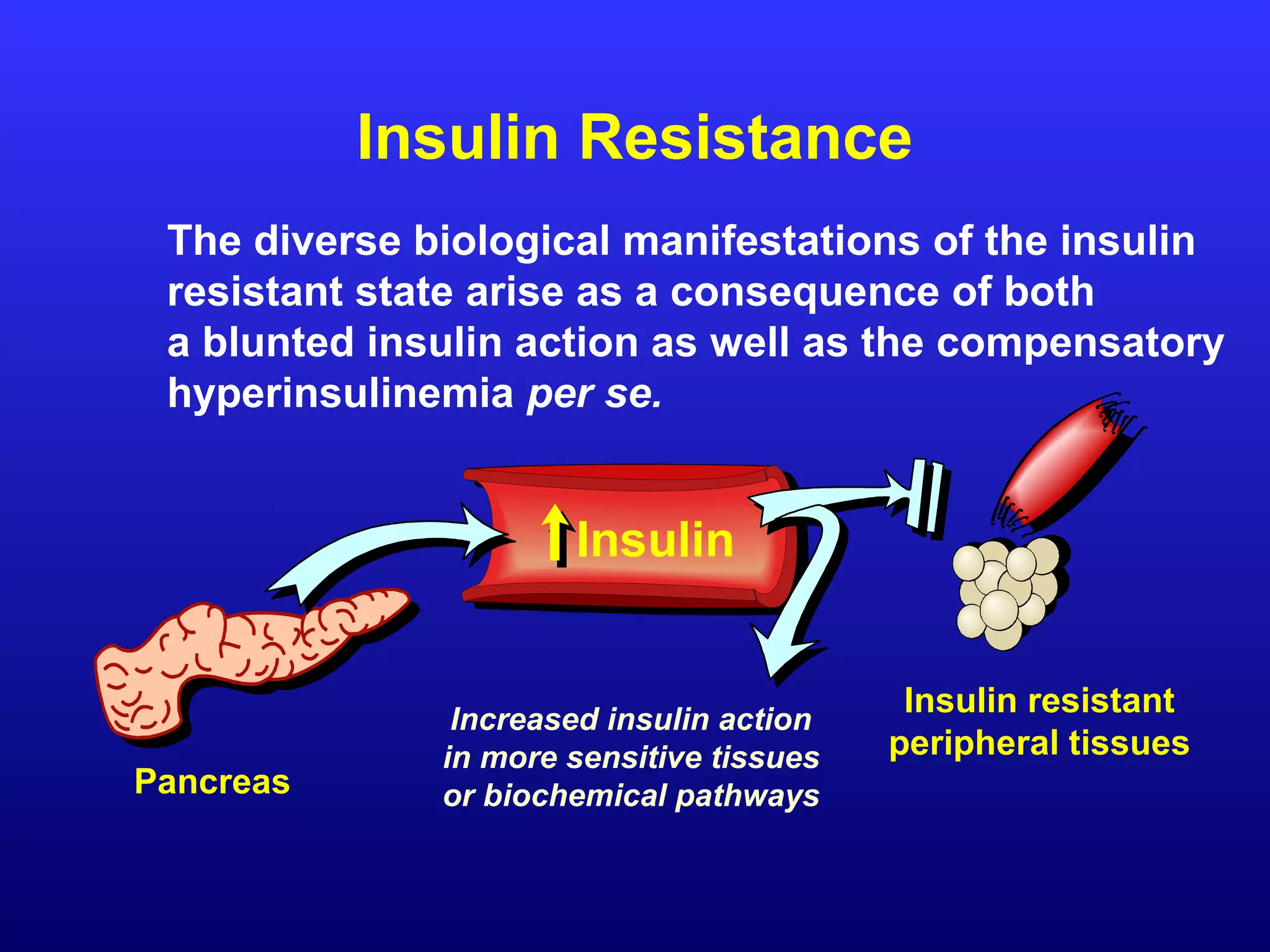 The diverse biological manifestations of the insulin
resistant state arise as a consequence of both
a blunted insulin action as well as the compensatory
hyperinsulinemia per se.
Insulin Resistance
Insulin resistant
peripheral tissues
Insulin
Increased insulin action
in more sensitive tissues
or biochemical pathwaysPancreas
 