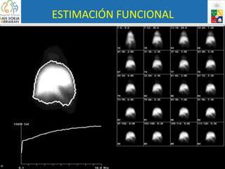 ESTIMACIÓN FUNCIONAL
 