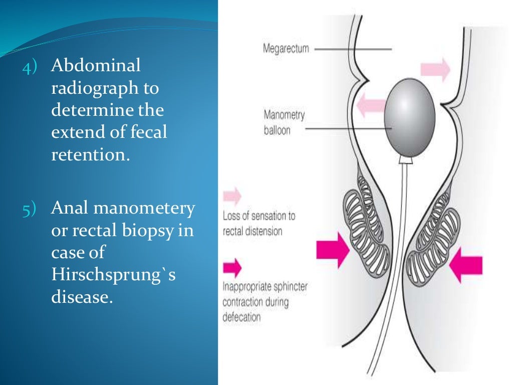 Encopresis (Soiling) In Pediatrics