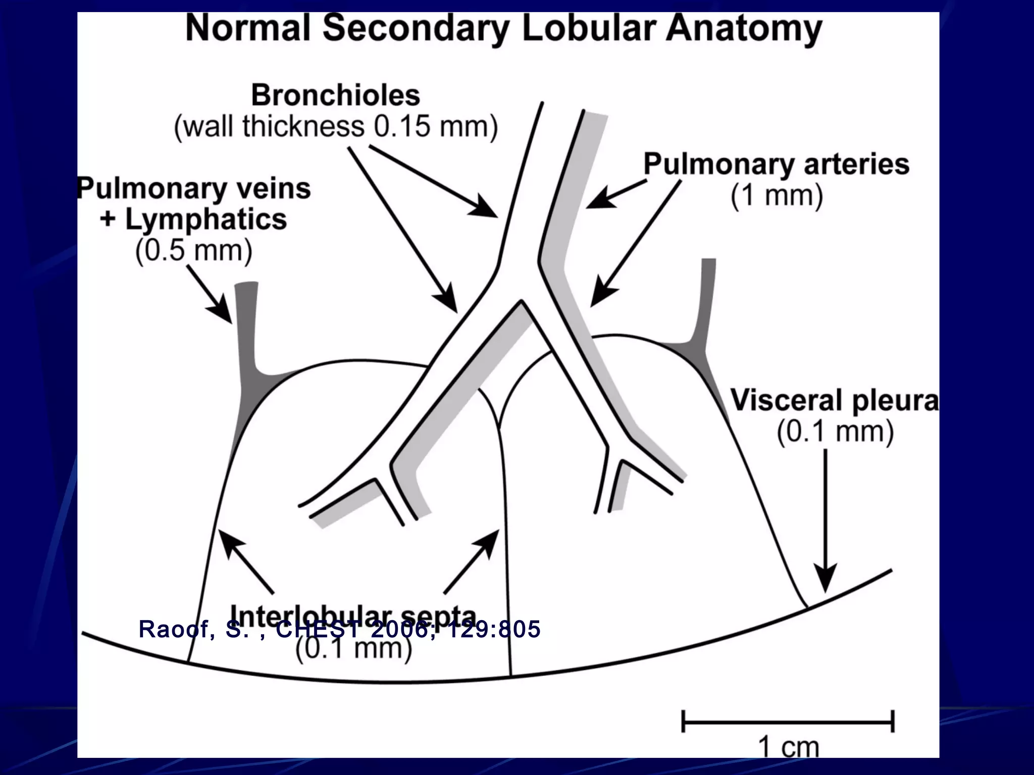 Raoof, S. , CHEST 2006; 129:805
 
