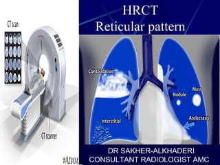 HRCT
Reticular pattern
DR SAKHER-ALKHADERI
CONSULTANT RADIOLOGIST AMC
 