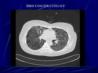 BIRD FANCIER LUNG H.P
 