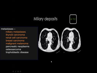 metastases –
miliary metastases
thyroid carcinoma
renal cell carcinoma
breast carcinoma
malignant melanoma
pancreatic neoplasms
osteosarcoma
trophoblastic disease
 
