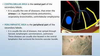 • CENTRILOBULAR AREA is the central part of the
secondary lobule.
• It is usually the site of diseases, that enter the
air...