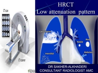 HRCT
Low attenuation pattern
DR SAKHER-ALKHADERI
CONSULTANT RADIOLOGIST AMC
 
