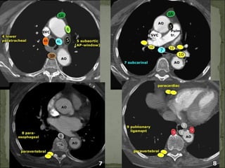 Hrct anatomy | PPT
