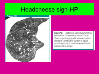 Headcheese sign-HP
 