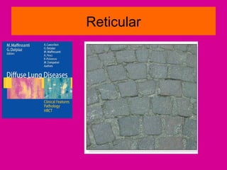 Reticular
 