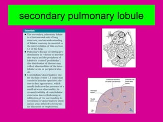 secondary pulmonary lobule
 