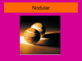 Nodular
 