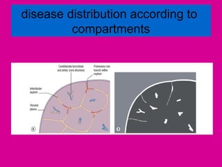 disease distribution according to
compartments
 