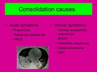 Consolidation causes.
• Acute Symptoms:
– Pneumonia
– Pulmonary edema,He.
– ARDS
• Chronic Symptoms :
– Chronic eosinophilic
pneumonia
– BOOP
– Interstitial pneumonia
– Lipoid pneumonia.
– BAC
 