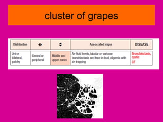 cluster of grapes
 