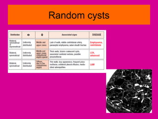 Random cysts
 