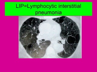LIP=Lymphocytic interstitial
pneumonia
 