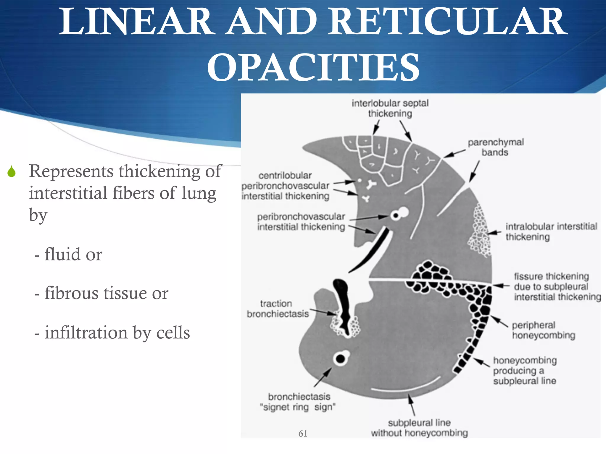 HRCT TECHNIQUE AND INTERPRETATION | PDF