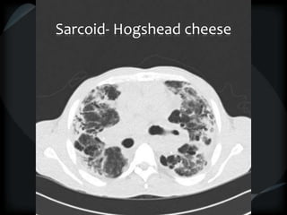 Sarcoid- Hogshead cheese
 