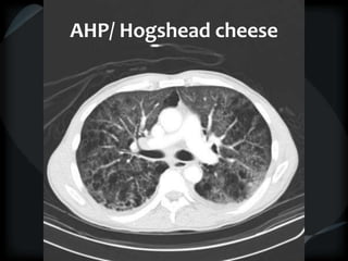 AHP/ Hogshead cheese
 
