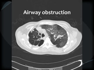 Airway obstruction
 