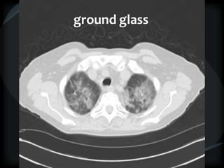 ground glass
 