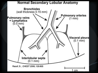 Raoof, S. , CHEST 2006; 129:805
 